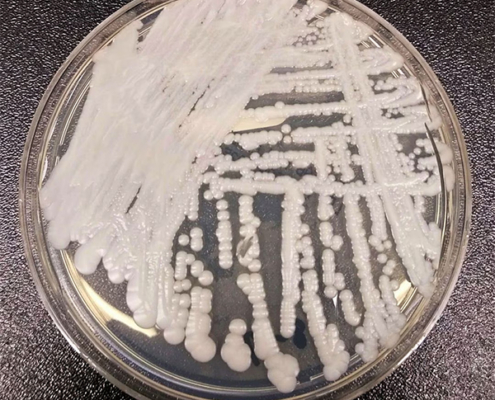 Candida auris