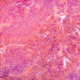 Micrograph, pancreas tissue