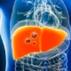 liver tumors