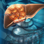 liver, cancer cells