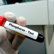 phosphorus tube